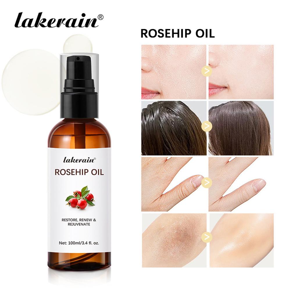 Aceite de rosa mosqueta para c - Cold Pressed Rose Hip reseña y precio