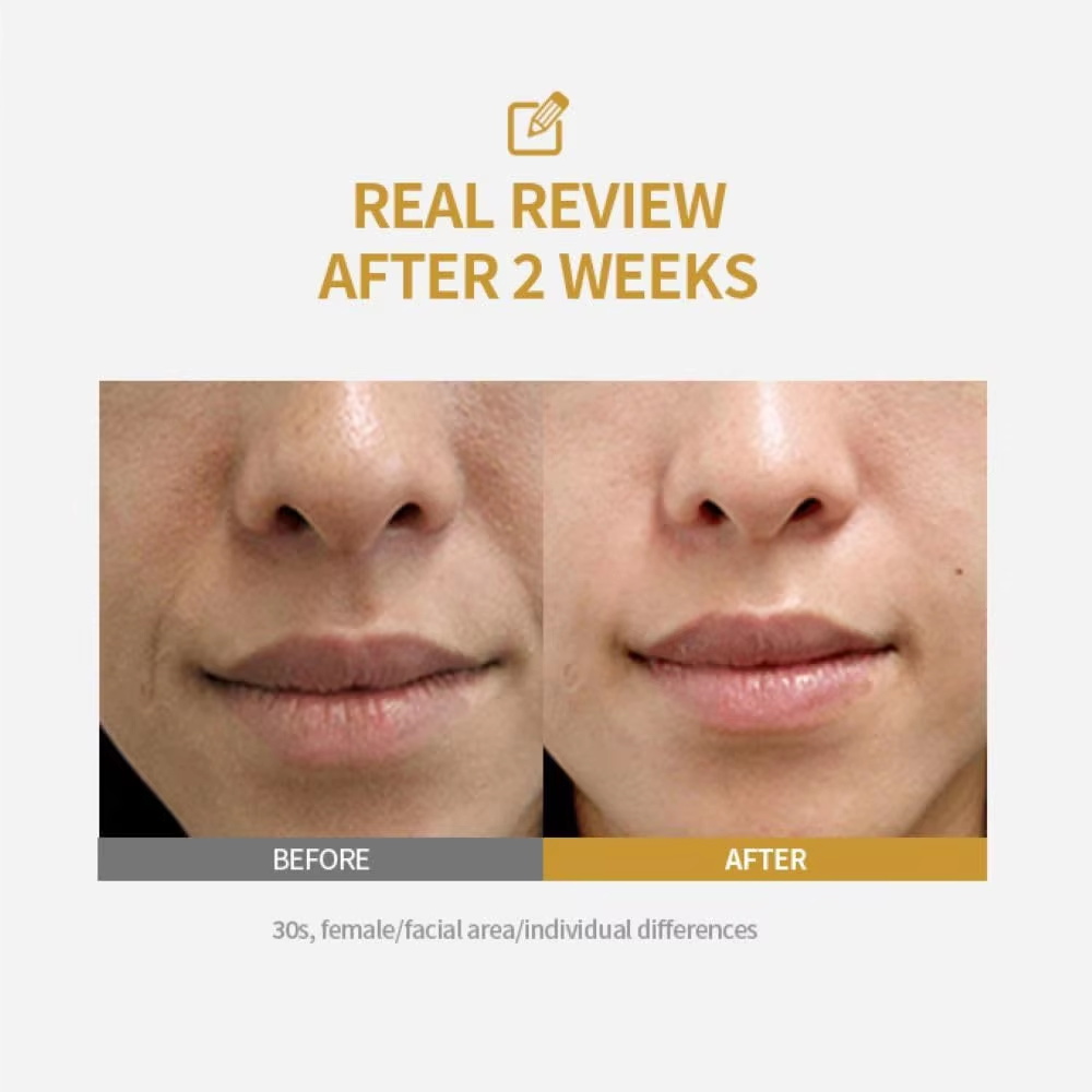 Ampolla de levantamiento inten - Peptide Complex Serum reseña y precio