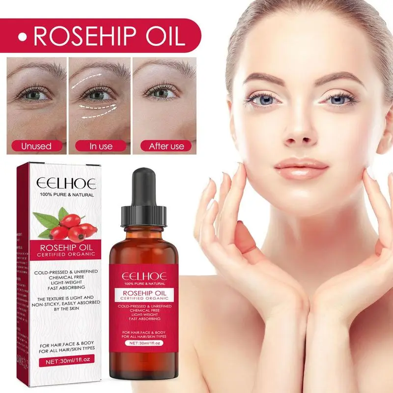 Aceite de semilla de rosa mosq - Cold Pressed Rose Hip reseña y precio